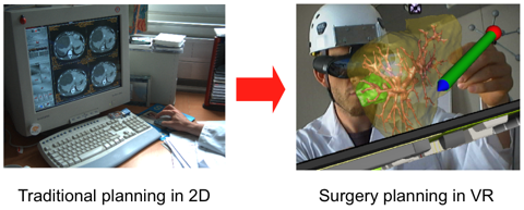 Graphics showing traditional vs VR surgery planning